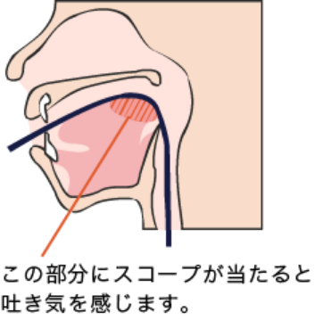 舌の付け根にスコープが当たると吐き気を感じます。