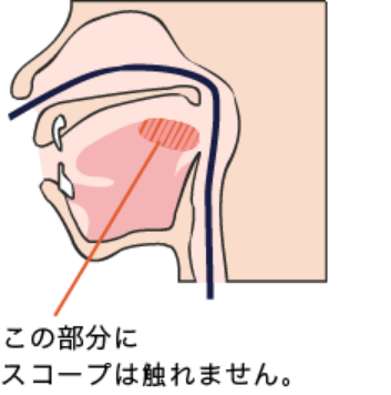 舌の付け根にスコープは触れません。